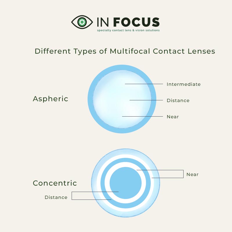 Illustration of multifocal contact lenses. Aspheric and concentric lens
