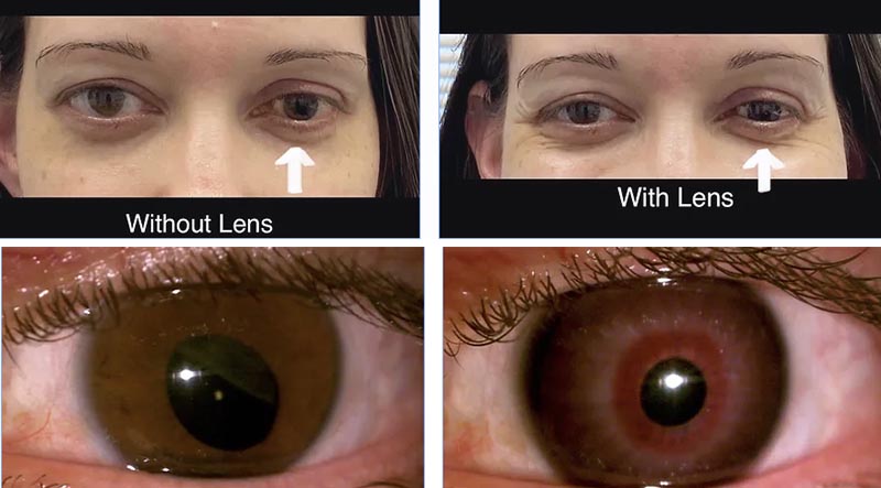 abnormally shaped pupil, and one eye that looked slightly smaller than the other