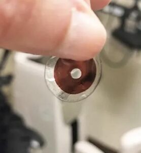 a simple brown prosthetic lens to be worn over their prosthetic cornea.
